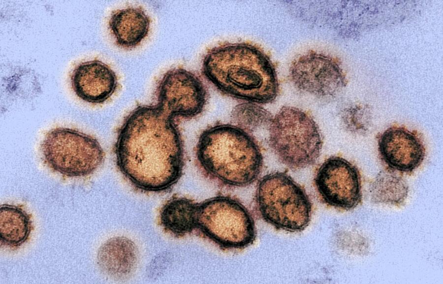 کشف گونه جدیدی از ویروس کرونا که عفونت خفیف تری ایجاد می نماید