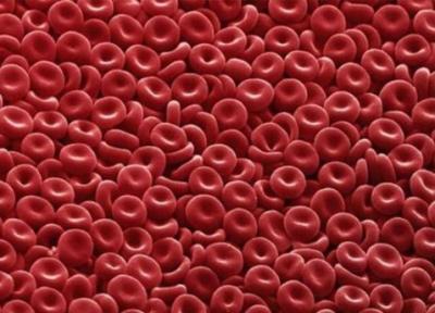 همه چیز راجع به پلی سیتمی یا افزایش گلبول های قرمز خون
